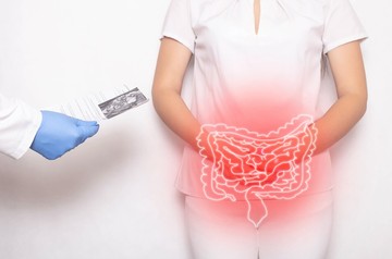 A Crohn-betegség oka, tünetei és kezelési lehetőségei