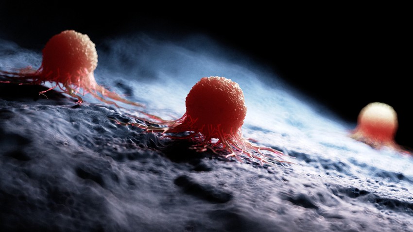 Amikor egy daganat áttétet képez, már nagy a baj, de korai felismerés mellett egyes áttétek még mindig jól kezelhetők!