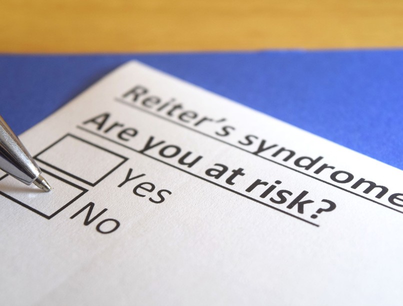 Reiter szindróma tunet vizsgálat kezelés