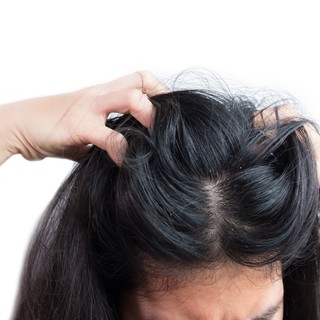 Mire utal a hajkorpásodás, hajzsírosodás? című cikk nyitóképe