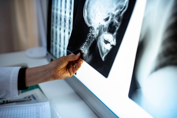 A házaspár beperelte a kórházat, miután elvesztették a férfi koponyájának egy részét