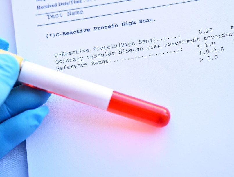 CRP érték Mit árul el