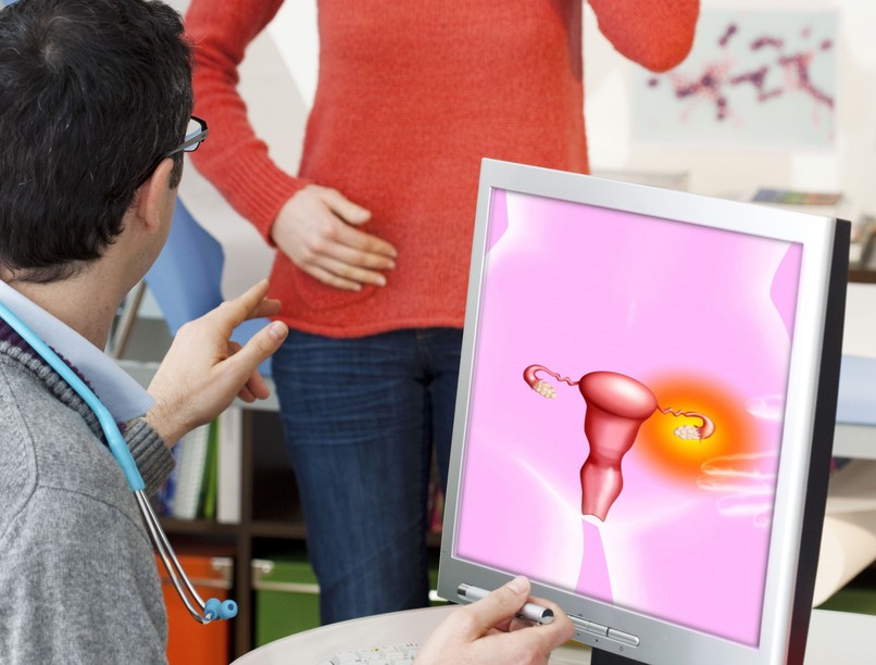 petefészekrák, hasfájás, hasi diszkomfort, tünet