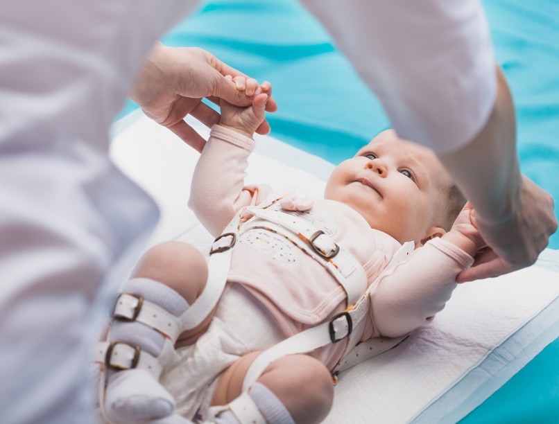 Veleszületett csípőficam tünet vizsgálat kezelés