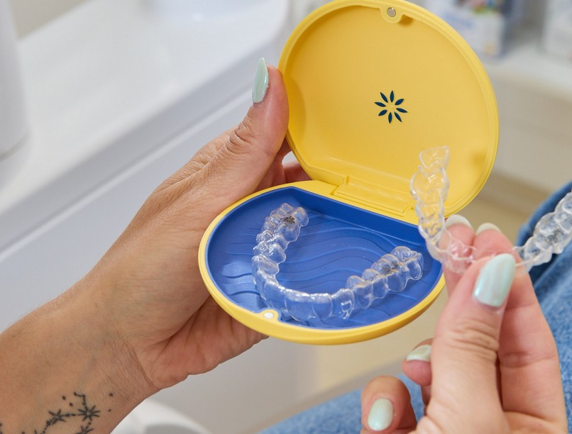 fogszabályozás, gyerek, fog