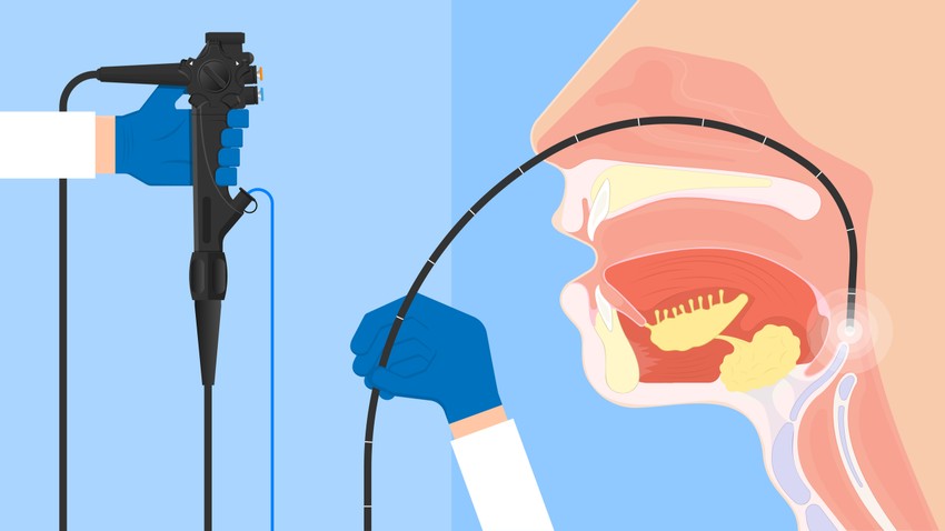 A kivizsgálás során számíthat laryngoscopos vizsgálatra a fül-orr-gégészeten, ilyenkor vékony endoszkóppal vizsgálják a gége, a hangszalagok mozgásait és állapotát. 