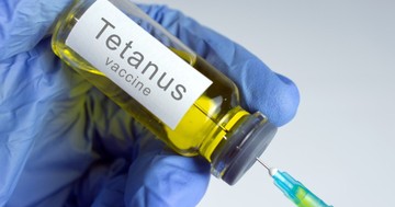 Meddig tart a tetanusz oltás hatása? Az orvos válaszol