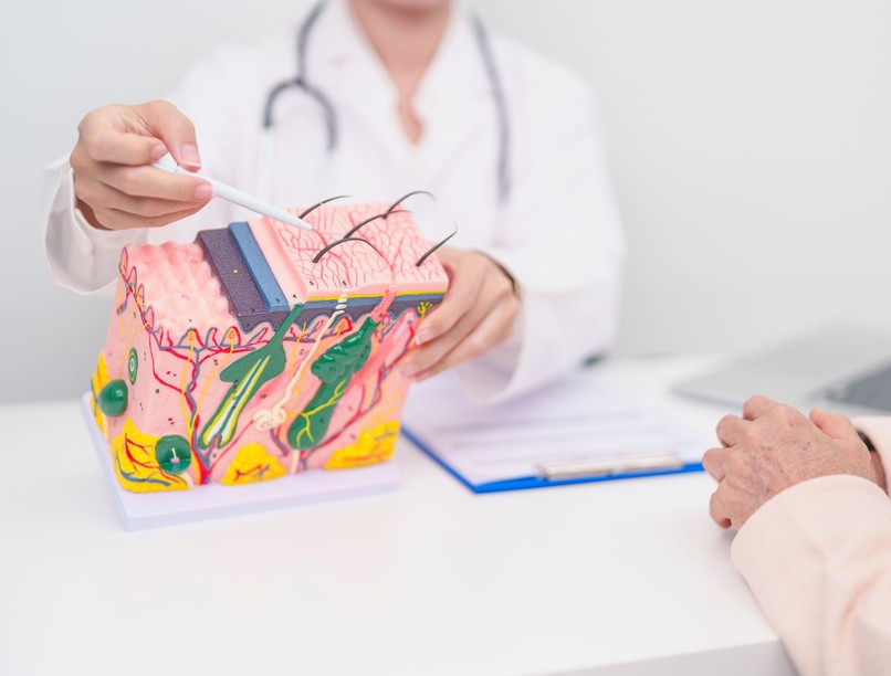 kemoterápia hajhullás mire lehet számítani