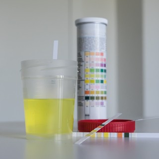 Mit jelentenek a ketontestek értékek a laborleleten? című cikk nyitóképe