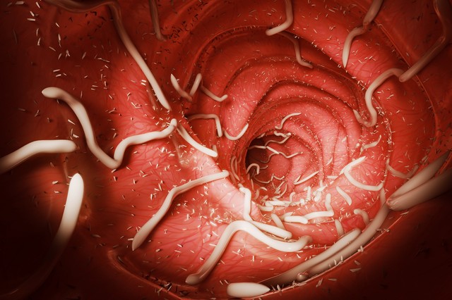 Orsóféreg fertőzés tünetei: ez történhet a beleivel, ha sok féreg gyűlik össze