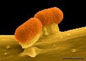 Fertőzéseink, fertőző betegségeink