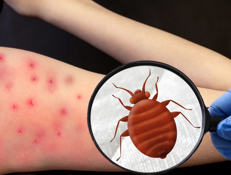 Hogyan ismerjük fel az ágyi poloskát?