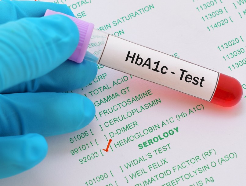 Mit jelent HbA1c érték laborlelet