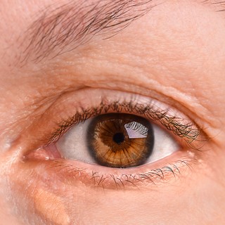 Ezzel az elváltozással jelzi a szeme, ha magas a koleszterinszintje című cikk nyitóképe