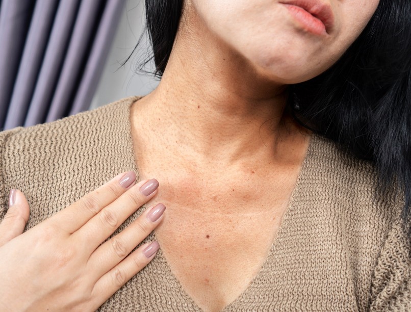 sötét szürke folt elszíneződés bőr acanthosis nigricans