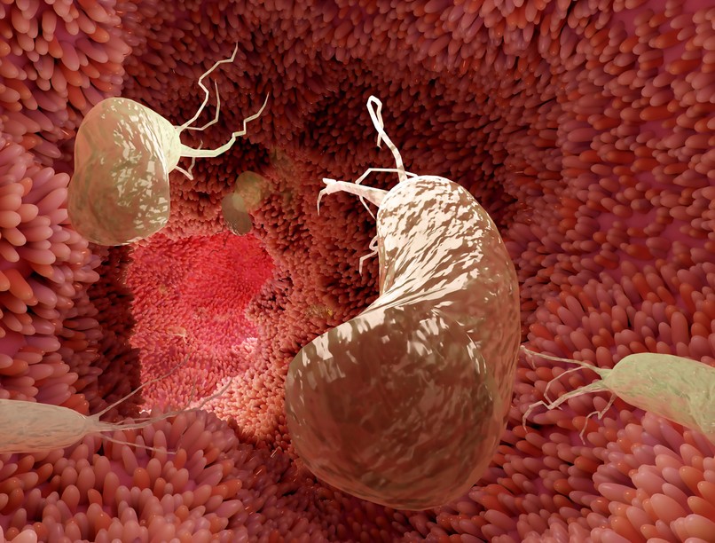 Helicobacter H. pylori ellen diéta