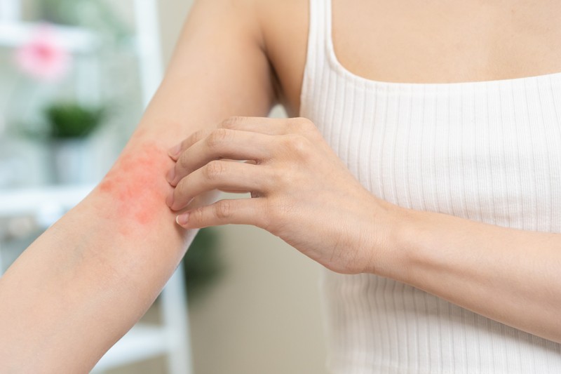 Ha ilyen folt jelenik meg a bőrén, azonnal menjen orvoshoz, gyógyszer mellékhatása is lehet!