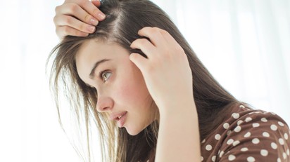 Foltos hajhullás - bár teljesen meggyógyítani nem lehet, de sokat tehet ellene című cikk nyitóképe