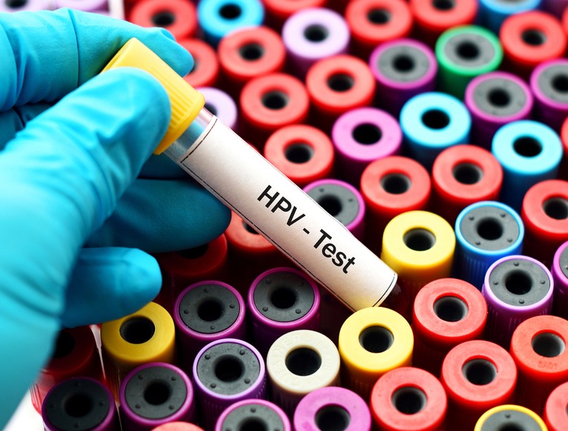 A HPV teszt elvégzéséhez keresse fel (bőrgyógyász, nőgyógyász, infektológus) orvosát.