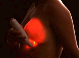 Új eszköz az emlő önvizsgálatára