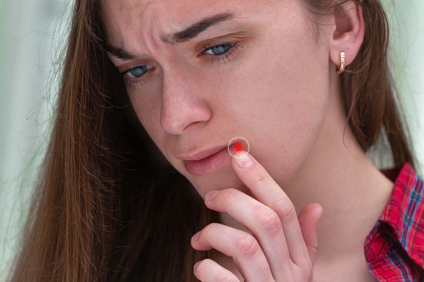 Az emberek nagyobb része életében valamikor átesik egy herpes simplex vírus fertőzésen (oka kontakt egy fertőzött egyénnel). Ezután a vírus már nem tűnik el a szervezetből, hanem az érzőidegen mentén bejut a ganglionokba, és ott "megbújik", lappang. 