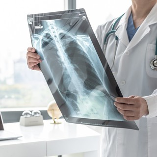 COPD: 500 ezer krónikus tüdőbeteg élhet Magyarországon, akik gyengébb tüdővel harcolnak a koronavírus ellen című cikk nyitóképe