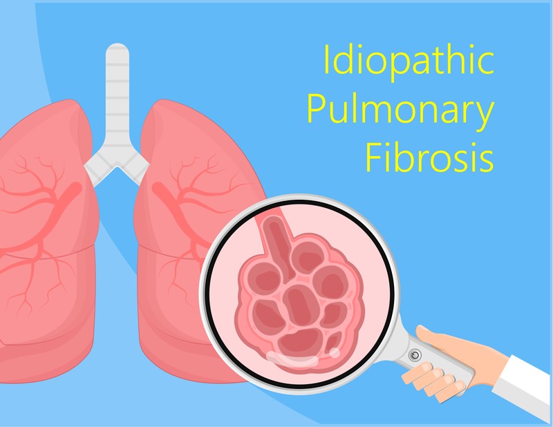 Valós veszély: ezek az idiopátiás tüdőfibrózis tünetei