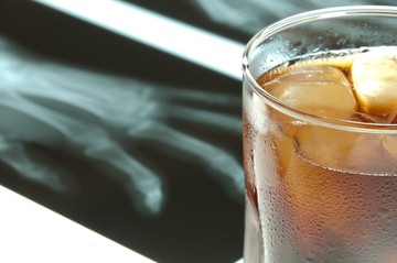 Nem csak a májat károsítja - ilyen daganatokat okozhat az alkohol