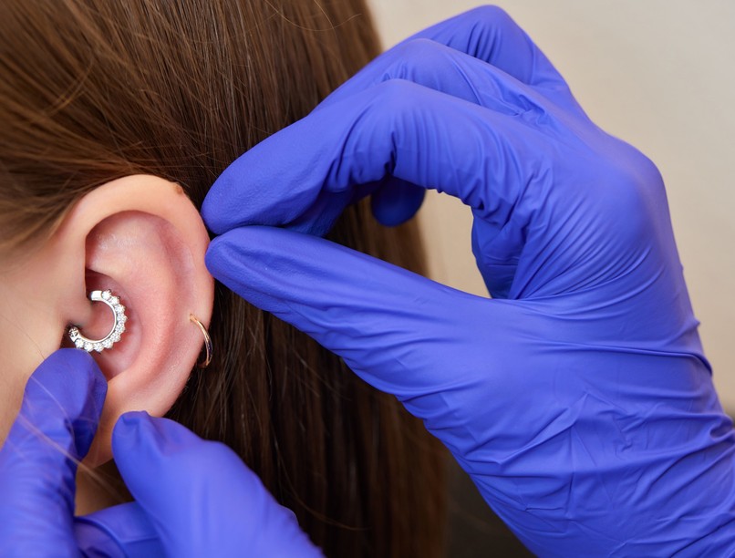 fejfájás, migrén, piercing, hatása