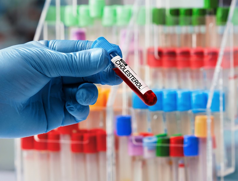 öröklött magas koleszterin szint értéke