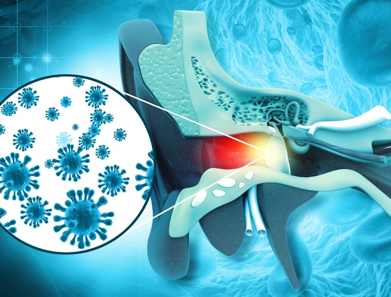 fülfájás, fülfájás kezelése, hallójárat-gyulladás, fülcsepp, fertőzés