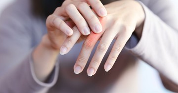 Zsibbad, sajog, gyenge a keze? A kézfájdalom leggyakoribb okai