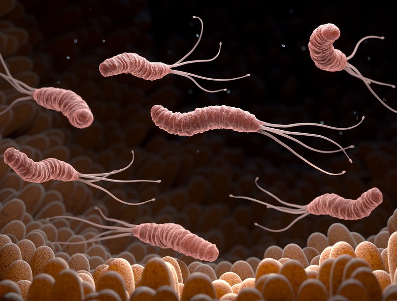 Helicobacter pylori baktérium fertőzés fekély gyomor rák fekély sok sav