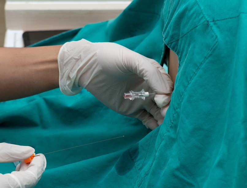 lumbálpunkció agy-gerincvelő folyadék vizsgálat leírás