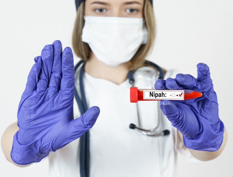 nipah, koronavírus, denevér, Kemenesi Gábor