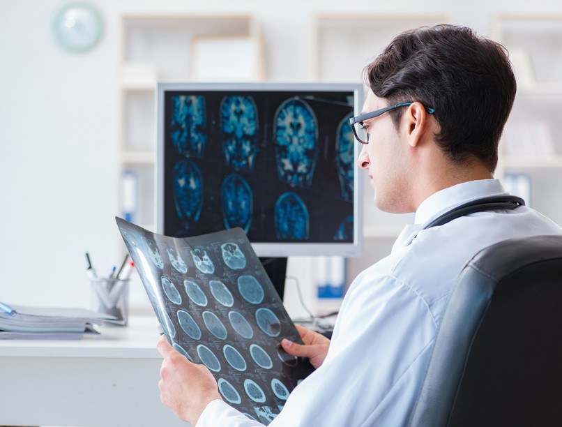 PTE új diagnosztikai műtéti eljárás epilepszia kezelés