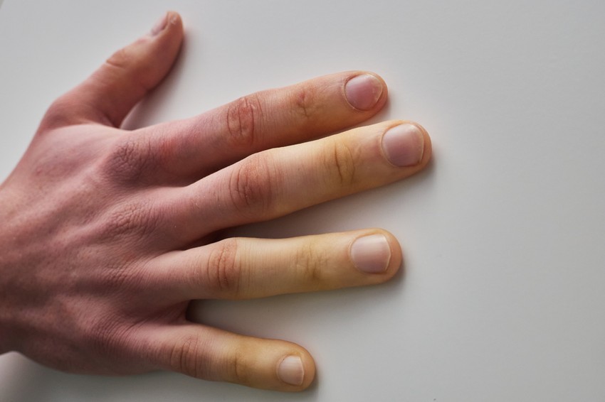 Pillantson rá a kezére, ez a hétköznapinak tűnő jel árulkodó lehet.