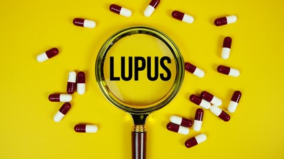 Lupusz – tünetek, diagnózis, kezelés: amit minden érintettnek tudnia kell című cikk nyitóképe