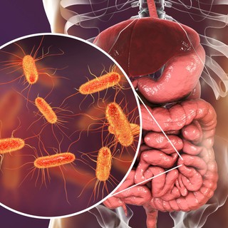 Tüdőrák: a bél mikrobiom felelős a daganat kialakulásáért? című cikk nyitóképe