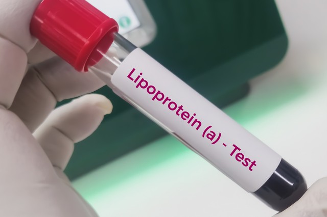 Magas lipoprotein(a)-szint: ezért fontos tudni az örökletes lipidzavarról