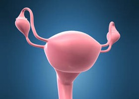 Valós veszély: endometriózis - és női meddőség