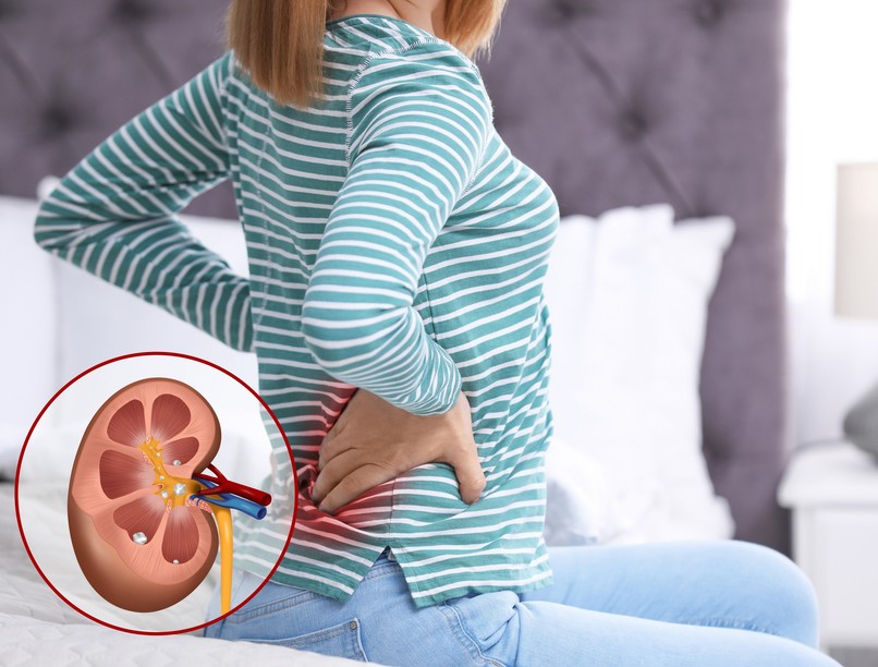 vesedaganat, veserák, tünet, kezelés