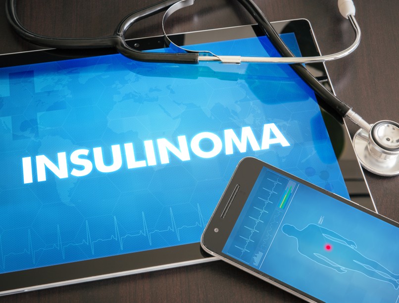 Inzulinóma
