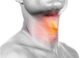 Laryngitis (gégegyulladás)