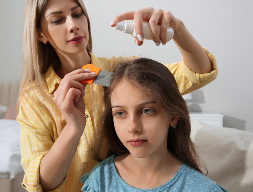 tetű fejtetű vírus fertőzés tetűírtó kezelése