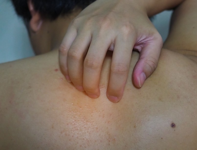 hasnyálmirigyrák allergia viszket tünet