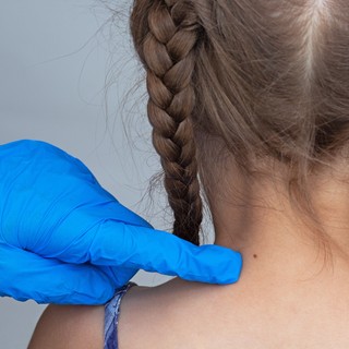 Mikor kell először elvinni a gyereket anyajegyszűrésre? című cikk nyitóképe