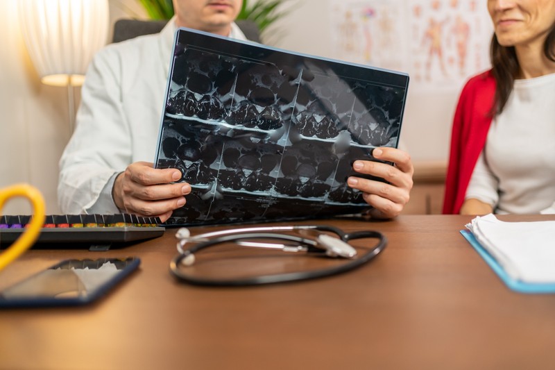 Szklerózis multiplex végső stádiuma: így segíthet, ha súlyosbodik a betegség