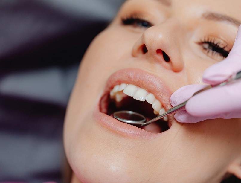 fogszuvasodás, gyökérkezelés romló fogak