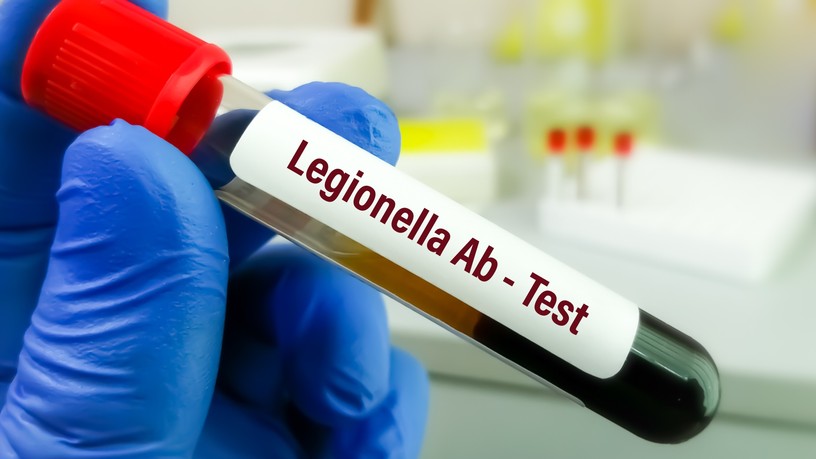 Legionárius betegség, legionellosis oka tönet kezelés